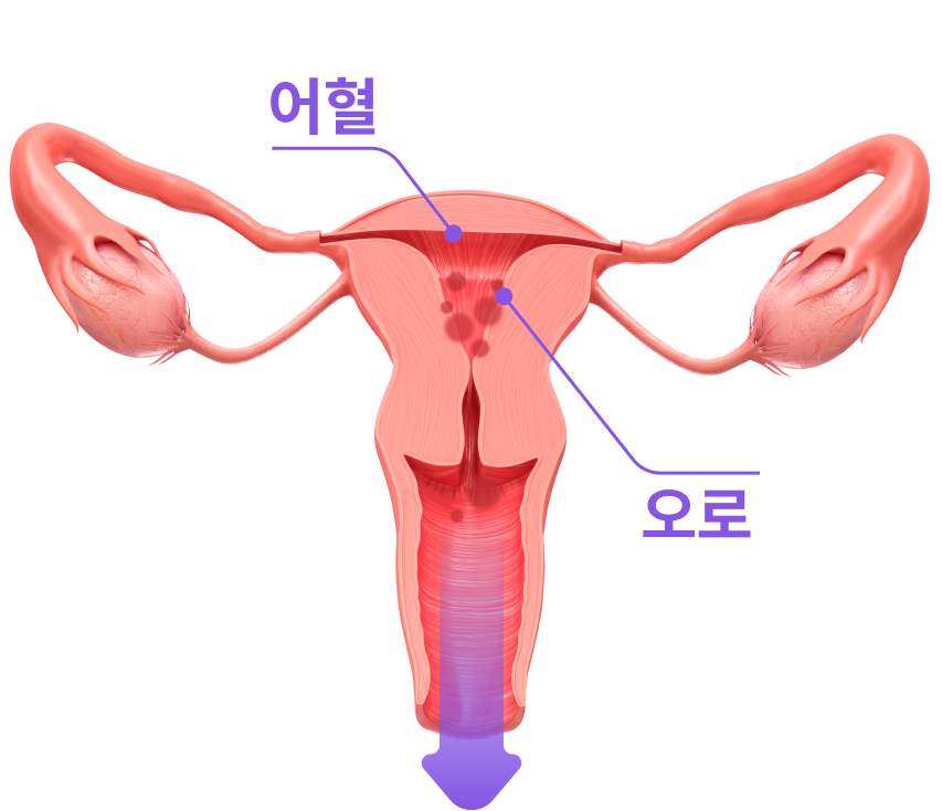 어혈과 오로의 배출